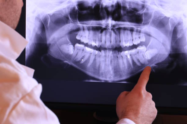 Best Emergency Wisdom Teeth Removal in The College Of New Jersey, NJ